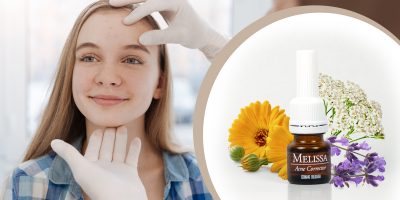 Лосион за акне с натурални био съставки от Екомаат